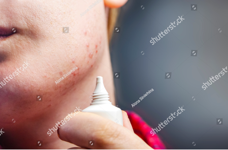 raw-image