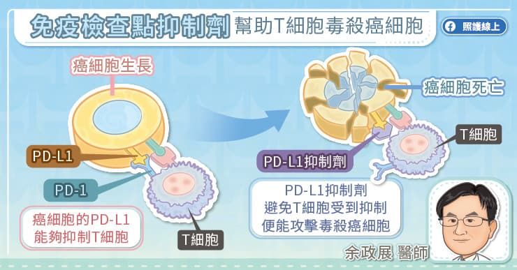 免疫檢查點抑制劑幫助T細胞毒殺癌細胞