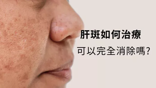 raw-image